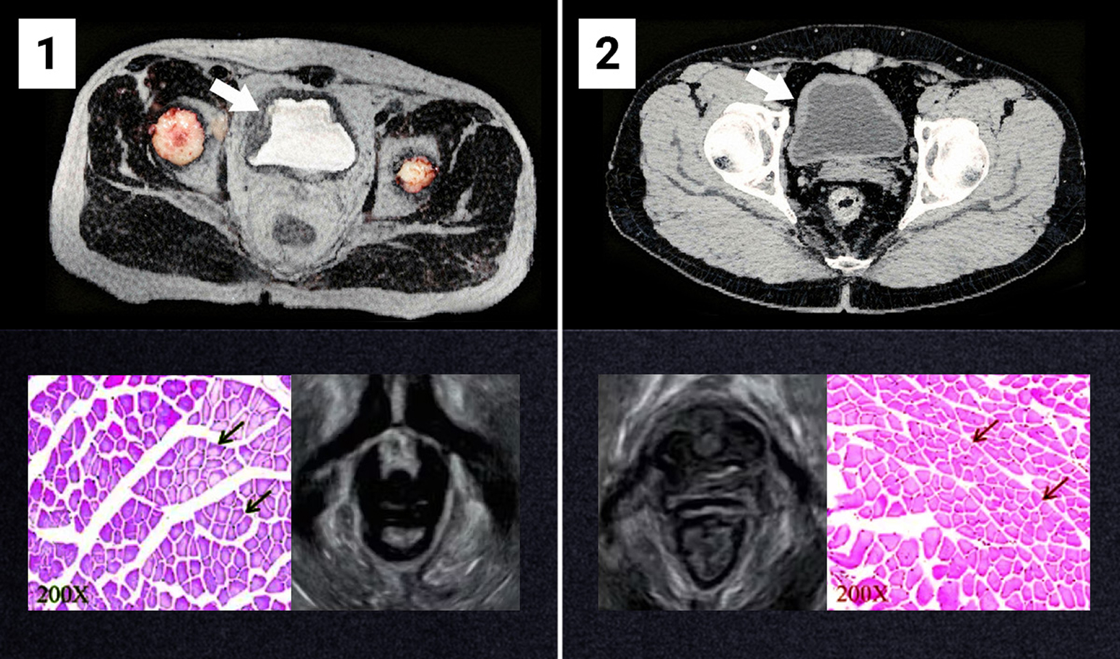 Lékařské snímky močového měchýře